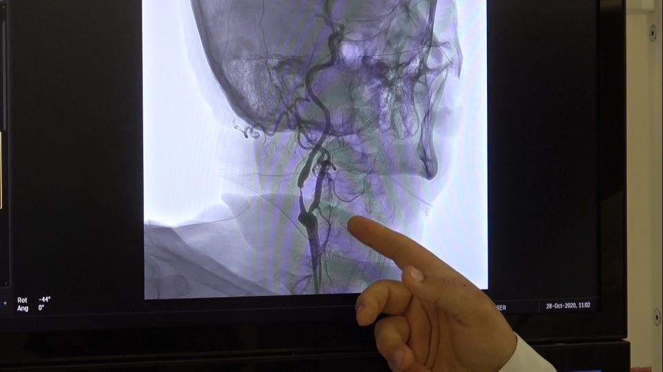 Kan sulandırıcı kullananlara hayati uyarı!