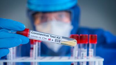 Koronavirüs test sonucu nasıl öğrenilir?