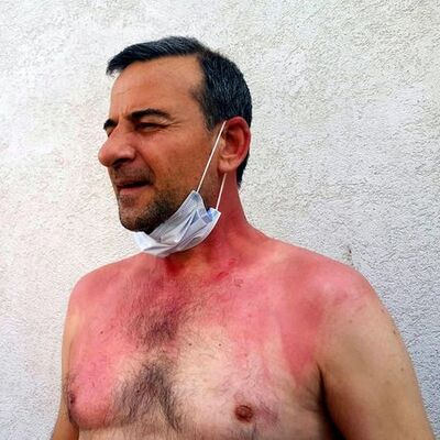 Sigara dumanı kavgası! Kaynar suyla yaktı