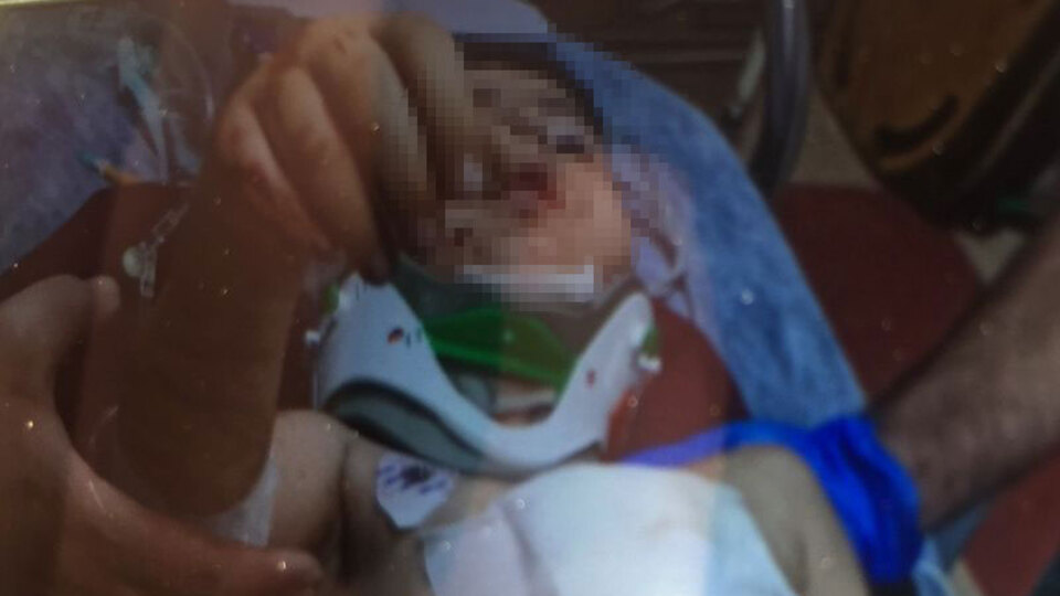 Patlamanın nedeni EYP çıktı! Çocuğun yanında bomba imalatı!