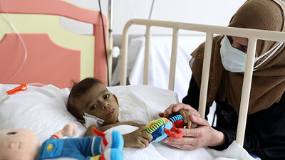 Tamer bebek için sınır ötesi karaciğer operasyonu