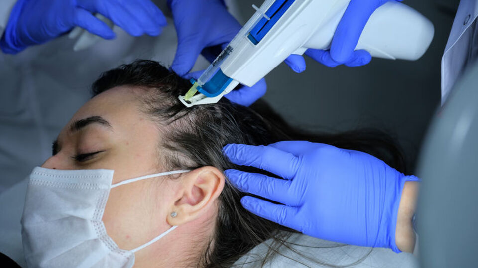 Koronayı geçirenlerde saç dökülmesi