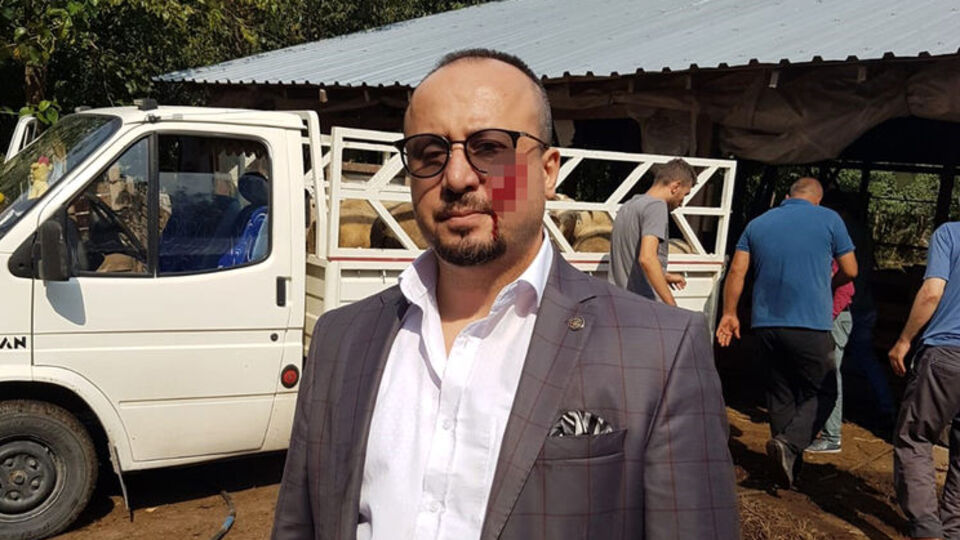 Avukatı yanağından ısıran sanığa ceza