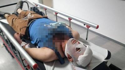 15 yaşındaki kızı kaçırmak için kanlı baskın