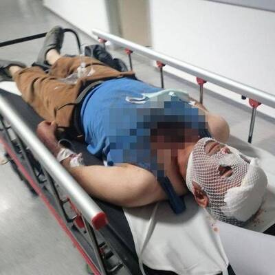 15 yaşındaki kızı kaçırmak için kanlı baskın