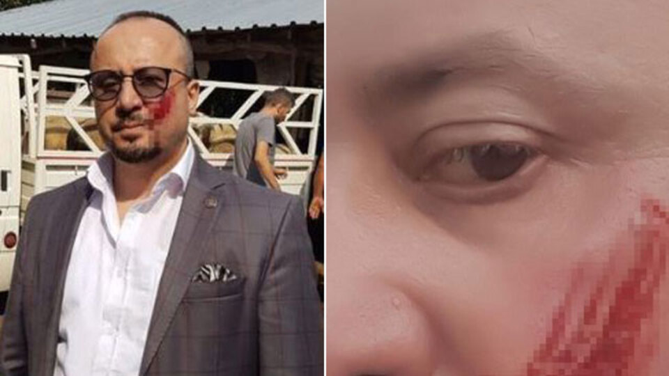 Yanağı koparılan avukat isyan etti!