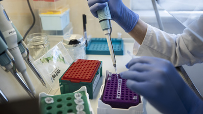 Bakan Varank'tan yerli aşı açıklaması: En az 480 gönüllü aranıyor