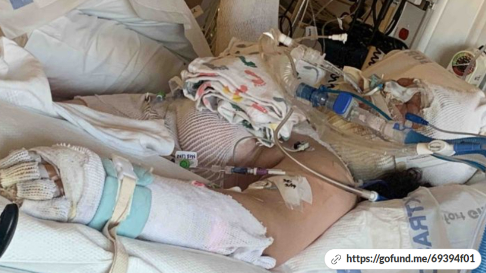 Tiktok faciası! Yanlışlıkla kendini yaktı