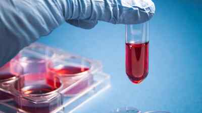 Vaccizone'a Keiretsu'dan yatırım!