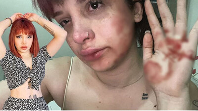 Tayt yüzünden feci şiddet iddiası!