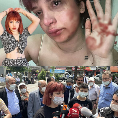 Tayt yüzünden feci şiddet iddiası!