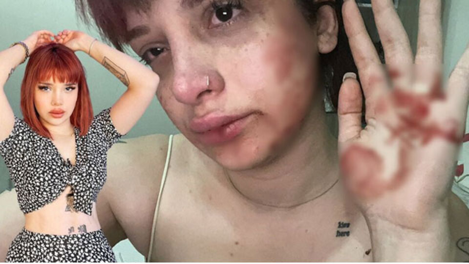 Tayt yüzünden feci şiddet iddiası!