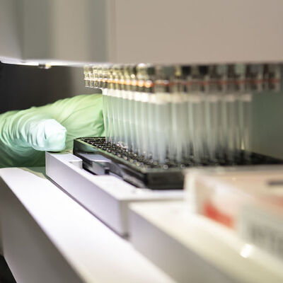 18 yıl sonra bir Alzheimer ilacının kullanımına onay verildi