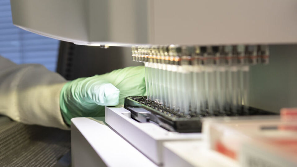 18 yıl sonra bir Alzheimer ilacının kullanımına onay verildi