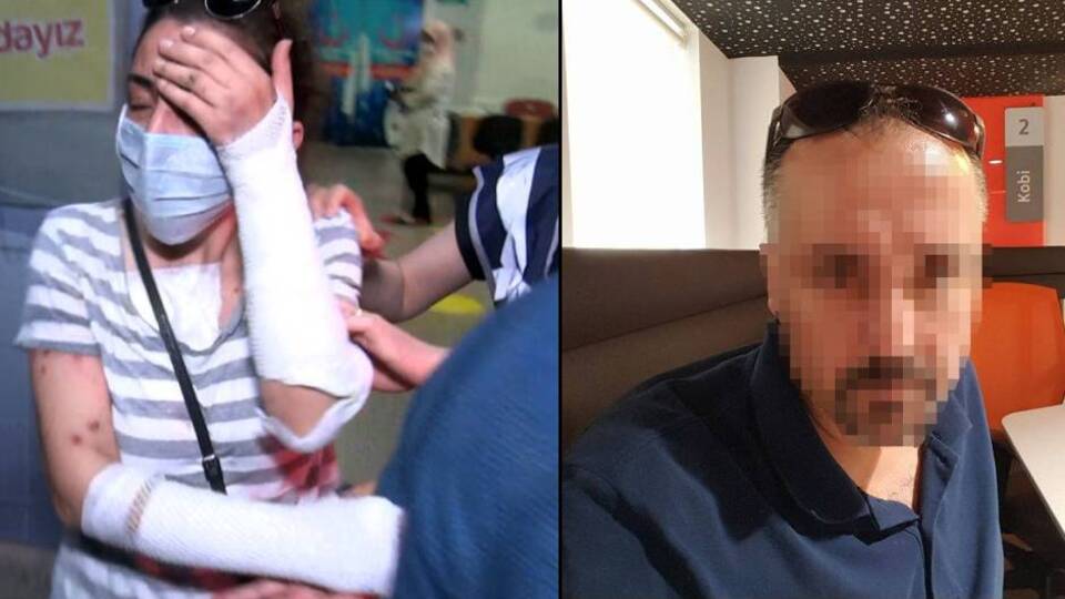 Eski sevgilisine kezzap atmıştı, flaş karar!