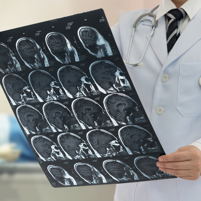 Nöroloji uzmanından müsilaj uyarısı: Felç riski