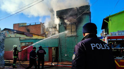 Çok acı! Yangında annesini kaybetmişti, şimdi elleri kesildi