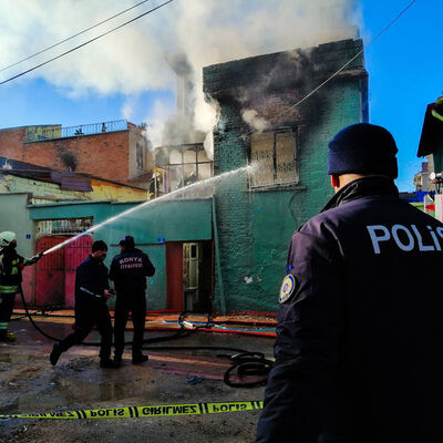 Çok acı! Yangında annesini kaybetmişti, şimdi elleri kesildi