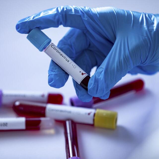 Başkasının test sonucuyla seyahate hapis cezası