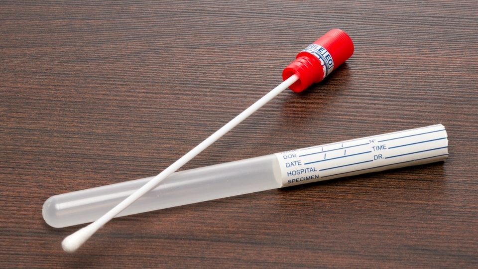 Swap testi ne demek?