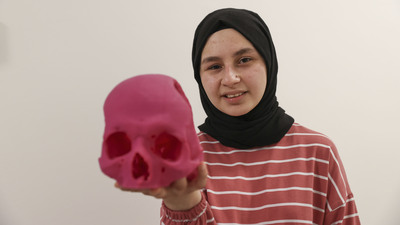 Yüzü yeniden gülüyor! Kafatasının bir bölümünü kaybetmişti!