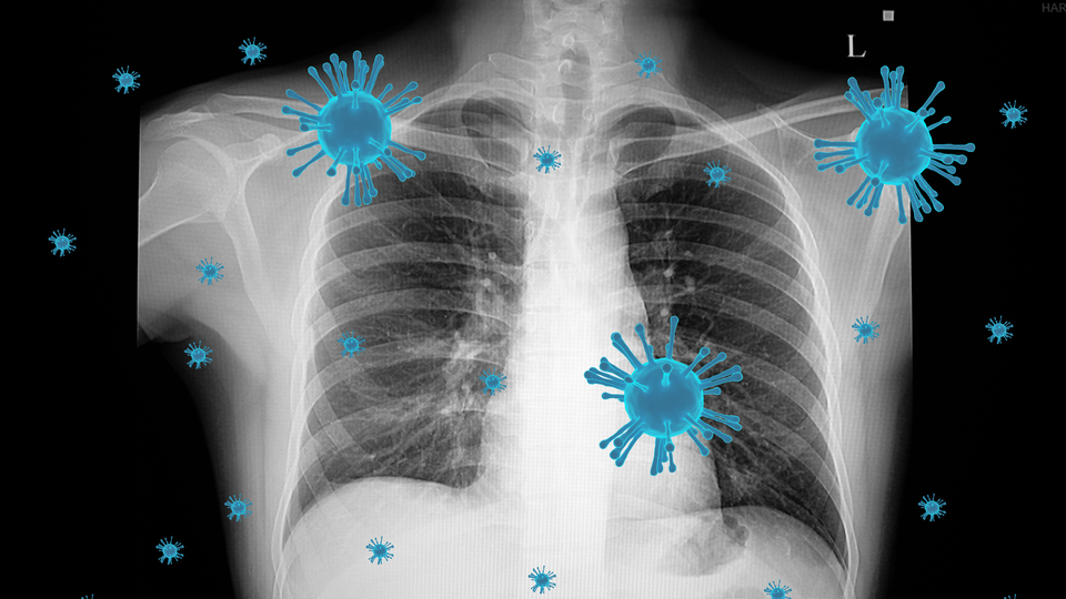 Covid'in kökeni ile ilgili 20 bin yıllık keşif