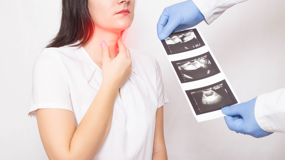 Kadınları daha çok vuruyor! İşte zehirli guatrın belirtileri