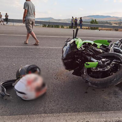 Korkunç kaza! Kazada kolu koptu