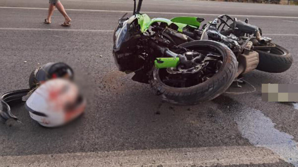 Korkunç kaza! Kazada kolu koptu