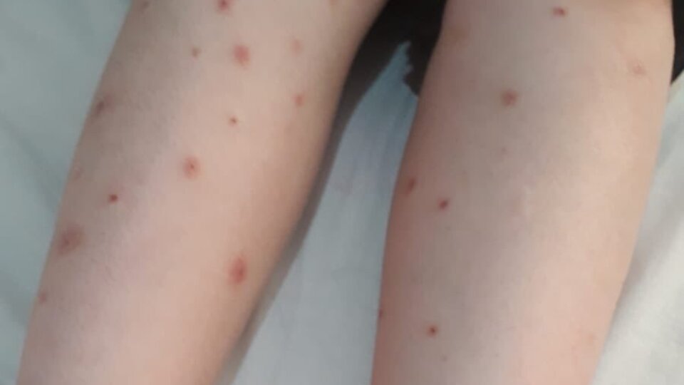 İstanbul'da sivrisinek kabusu!