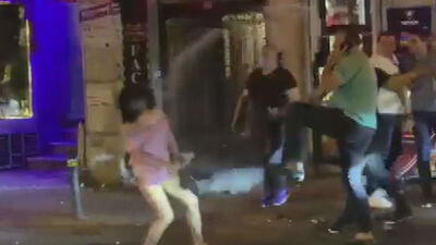 Bodyguardın parmağını kopardı! Şiddet gördü