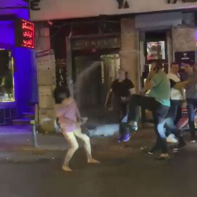 Bodyguardın parmağını kopardı! Şiddet gördü