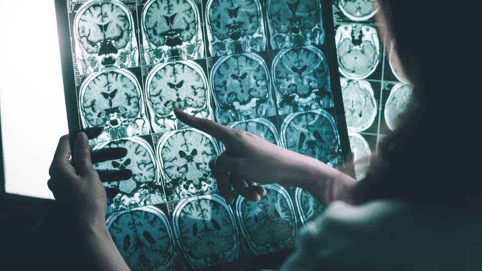 Alzheimer'dan korunmak için bıkıp usanmadan tekrar et