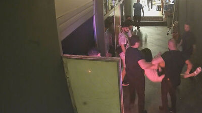 Parmak koparan kavgada kadınlar konuştu!