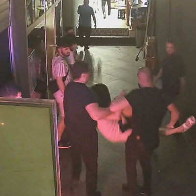 Parmak koparan kavgada kadınlar konuştu!