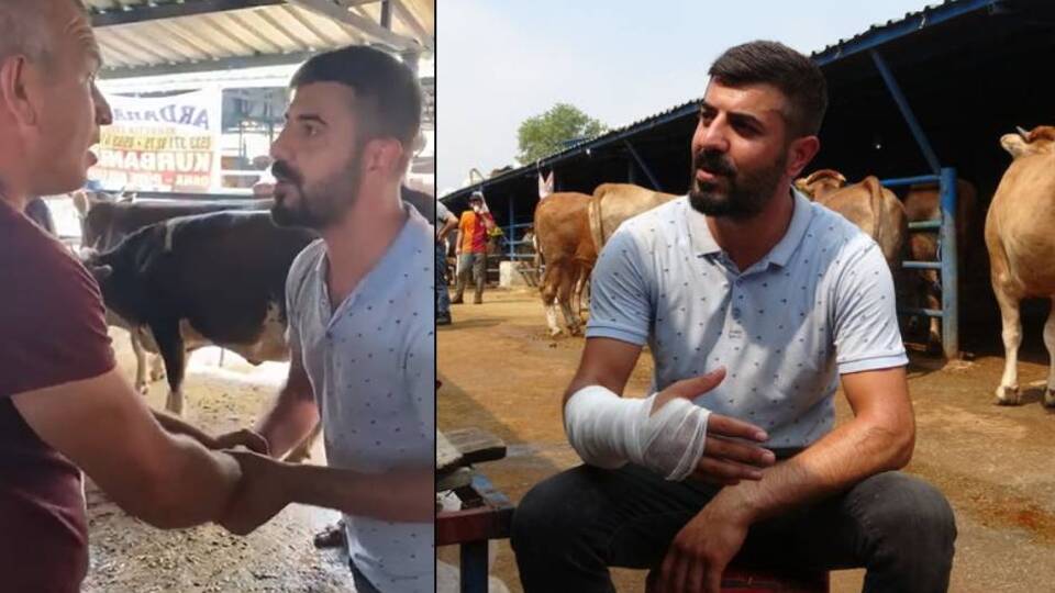 'Yok artık' dedirten pazarlık: Kolu çatladı