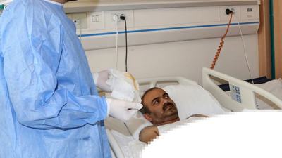 Çift kol nakli yapılan 5. hastaydı! Haber var