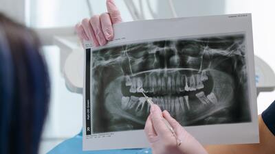 Hacker'lar 14 bin kişinin 'diş'ini çekti!