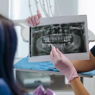 Hacker’lar 14 bin kişinin ‘diş’ini çekti!