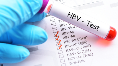 Dünyada 292 milyon kişi HBV ile enfekte!