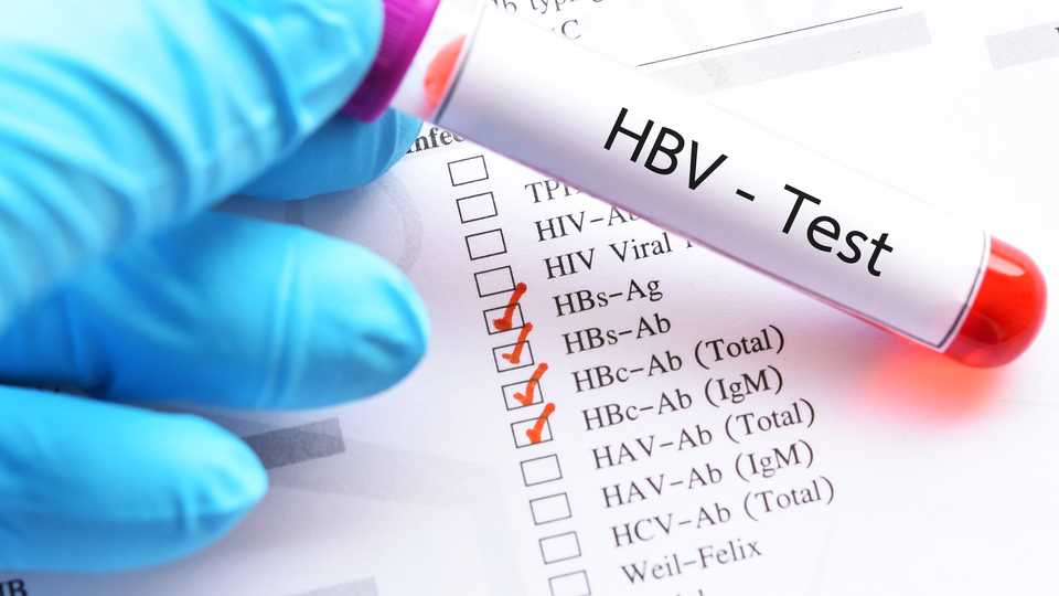 Dünyada 292 milyon kişi HBV ile enfekte!