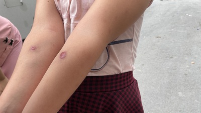 Sivrisinek alarmı! 'Ölümcül olabilir'