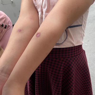 Sivrisinek alarmı! 'Ölümcül olabilir'