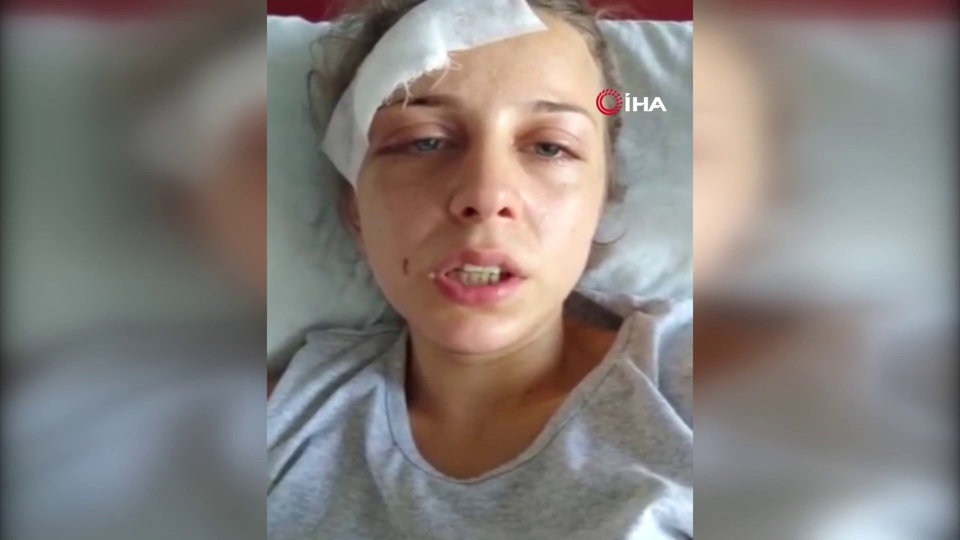 Eski karısını saatlerce darbetti!