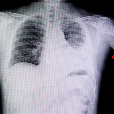 Bilim Kurulu Üyesinden kritik uyarı!