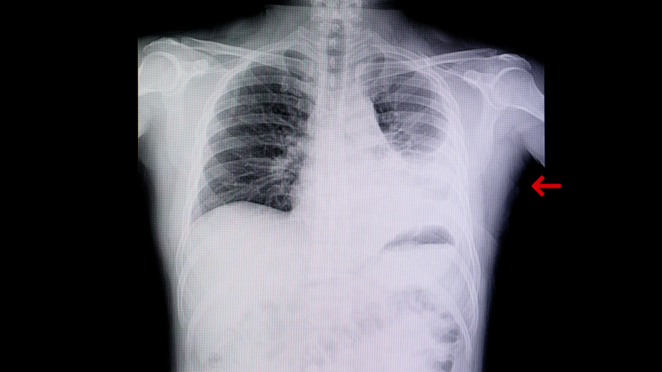 Bilim Kurulu Üyesinden kritik uyarı!