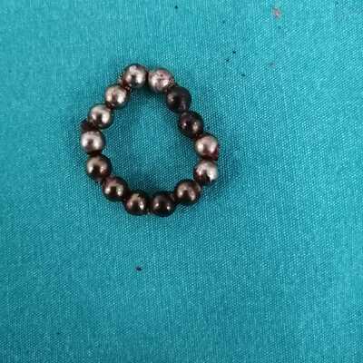 Bağırsakları delinerek alındı! Çocuklardan uzak tutun