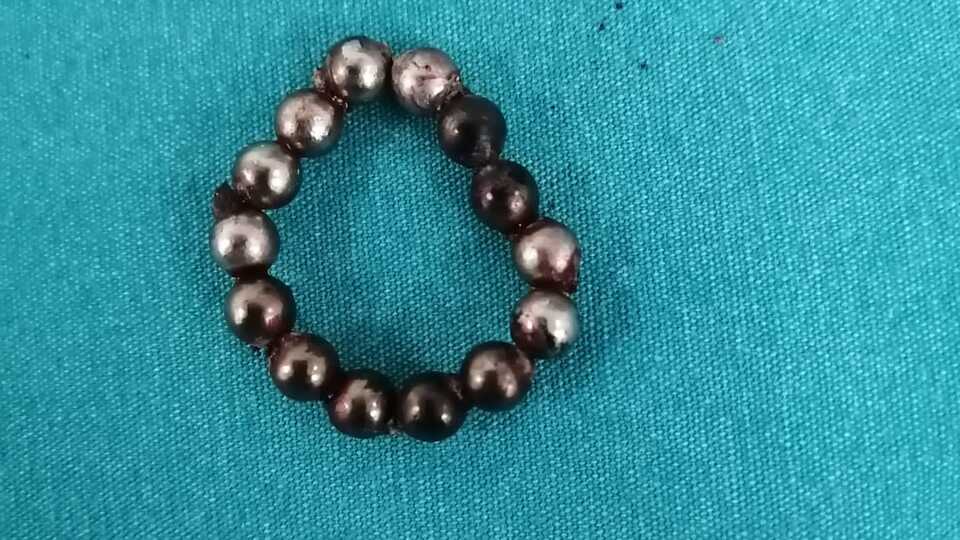 Bağırsakları delinerek alındı! Çocuklardan uzak tutun