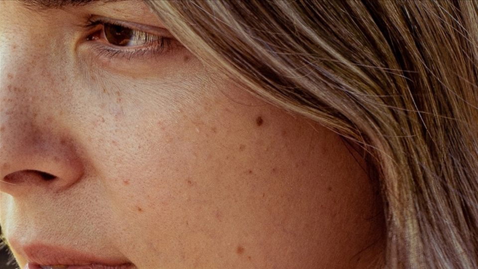 Vücuttaki benlerin gösterdiği değişimlere dikkat!