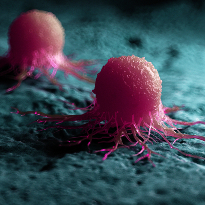 Araştırma ortaya koydu! Kanser vakalarını artırdı